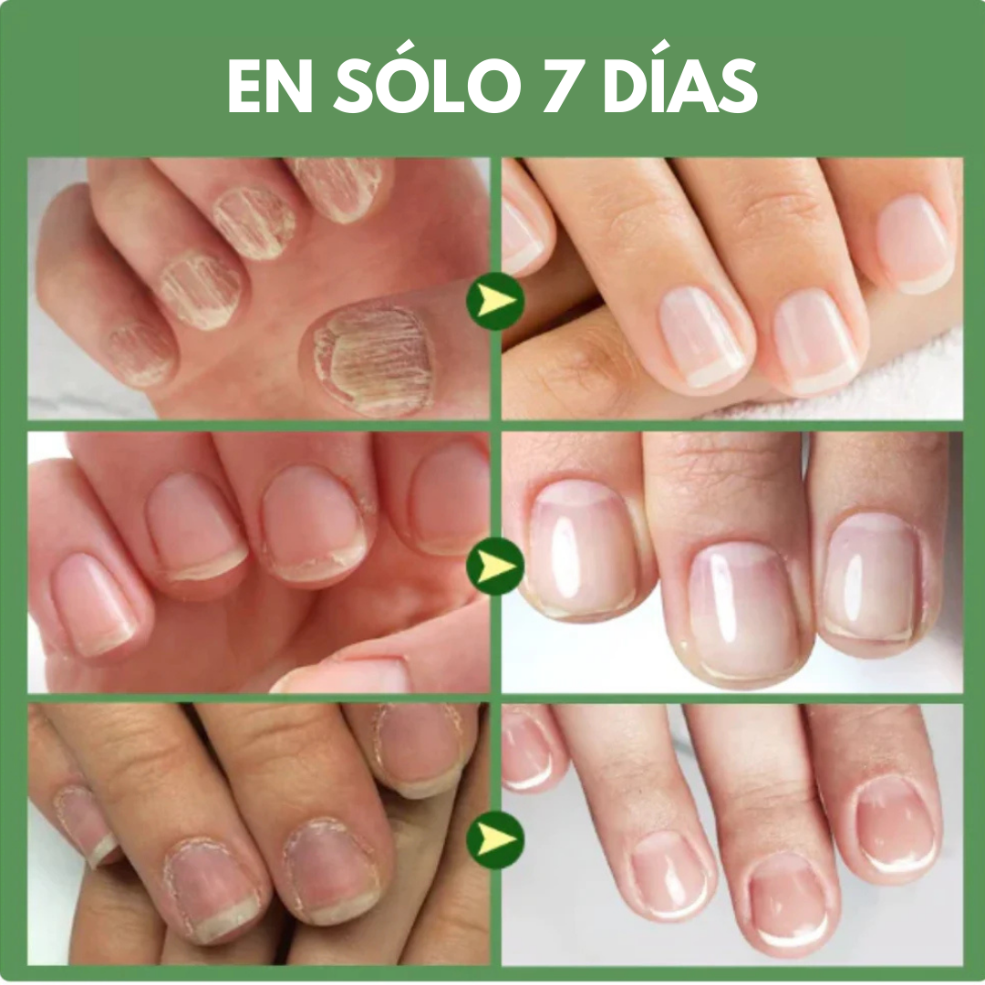 COMBO BASES ENDURECEDORA UÑAS DE TITANIO x 3